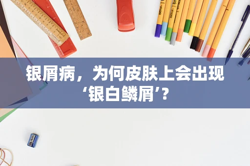 银屑病，为何皮肤上会出现‘银白鳞屑’？